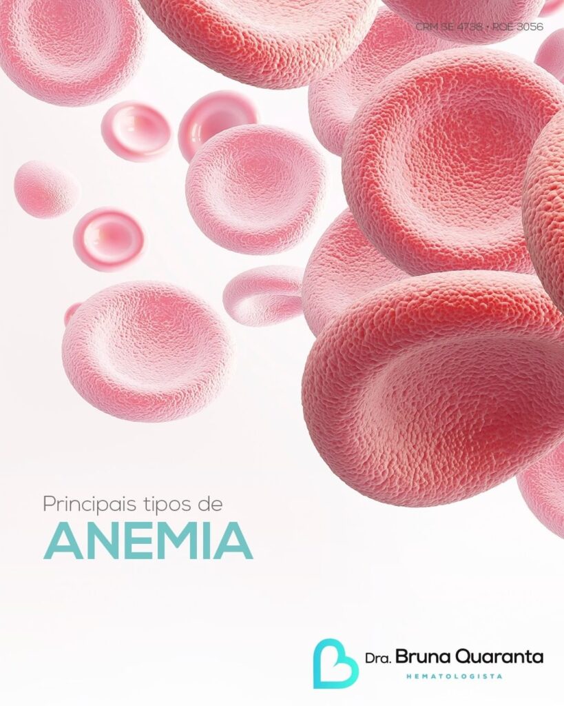 Principais Tipos De Anemia Dra Bruna Quaranta